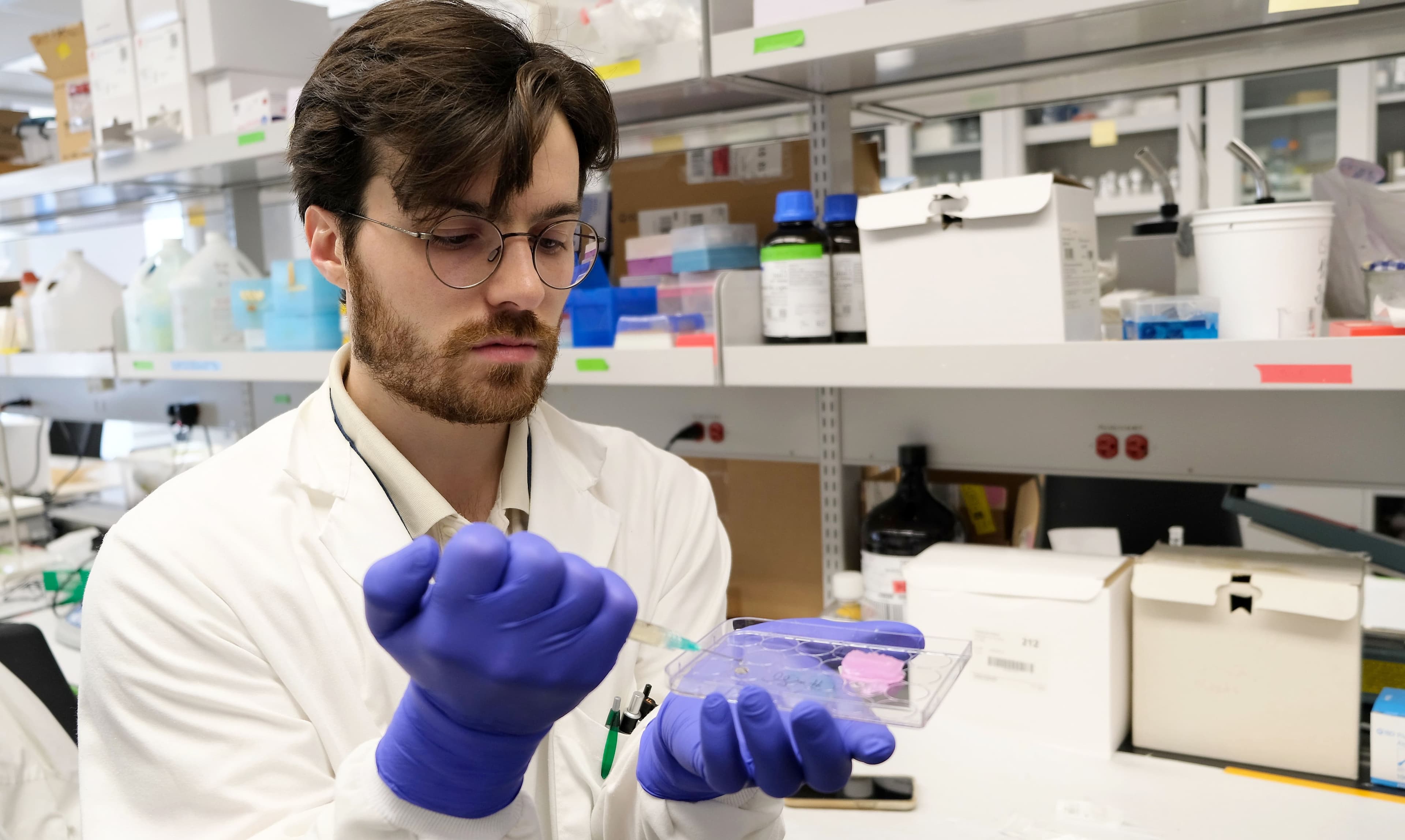 Étudiant au doctorat à l'ÉTS, Baptiste Marin travaille à l’élaboration d’un hydrogel permettant de rendre l’immunothérapie encore plus efficace contre les cancers.