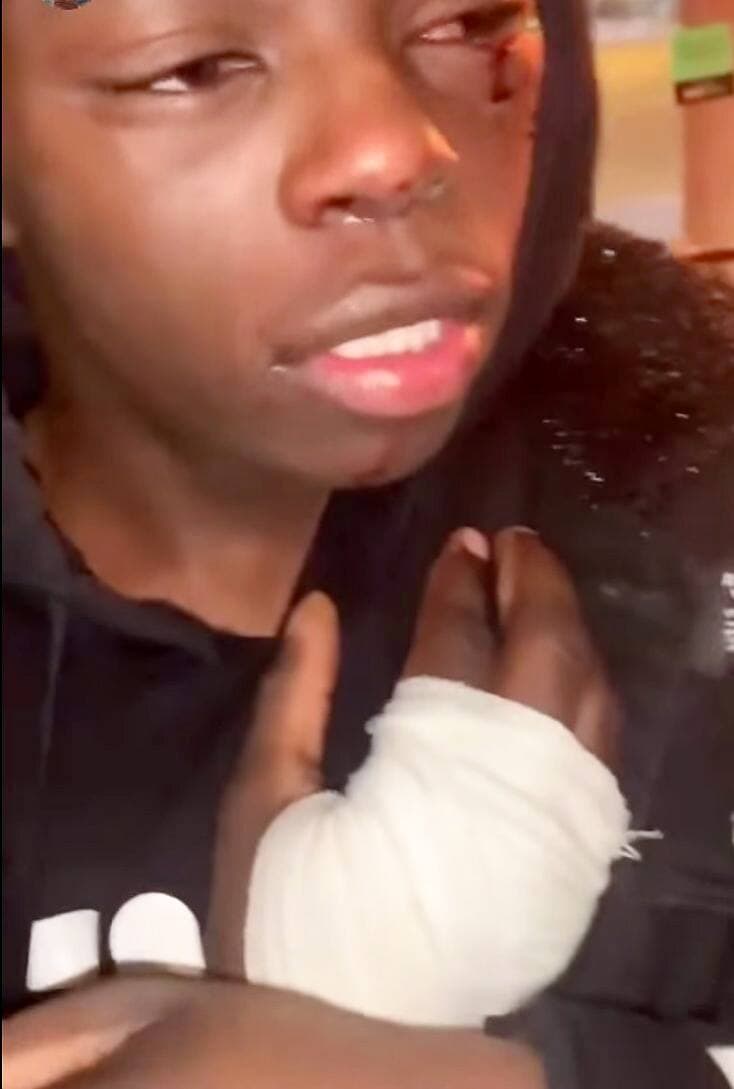 Pacifique Niyokwizera montrant ses blessures après l’arrestation.
