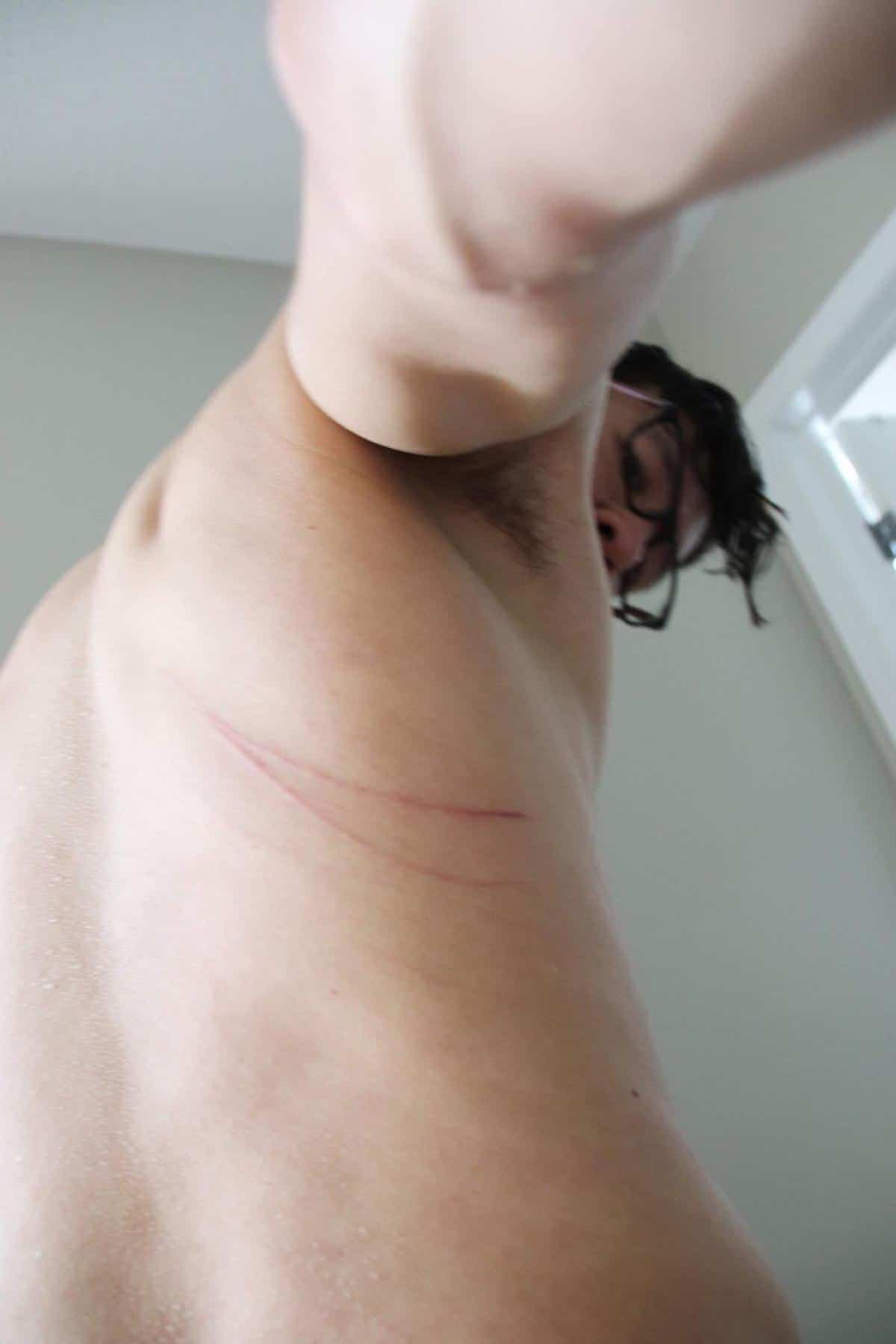 Maxime Gauthier-Kwan s'est fait attaquer par une dinde sauvage le 8 juillet dernier lors de son jogging dans un sentier boisé Ottawa, où il habite. La bête lui a même griffé le dos.