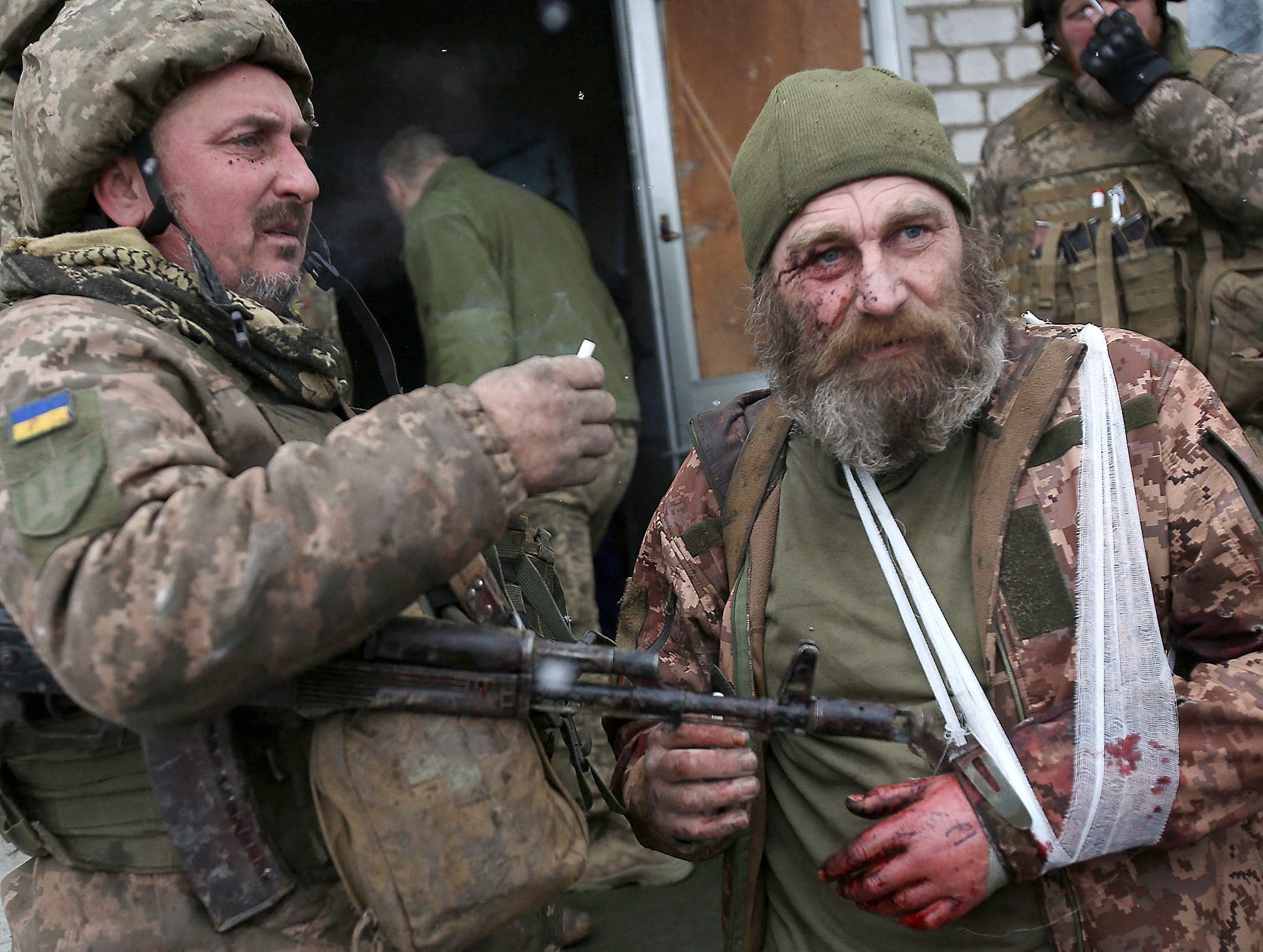 Un militaire ukrainien blessé fume une cigarette après avoir participé à des combats dans la région de Lugansk, au sud-est.
