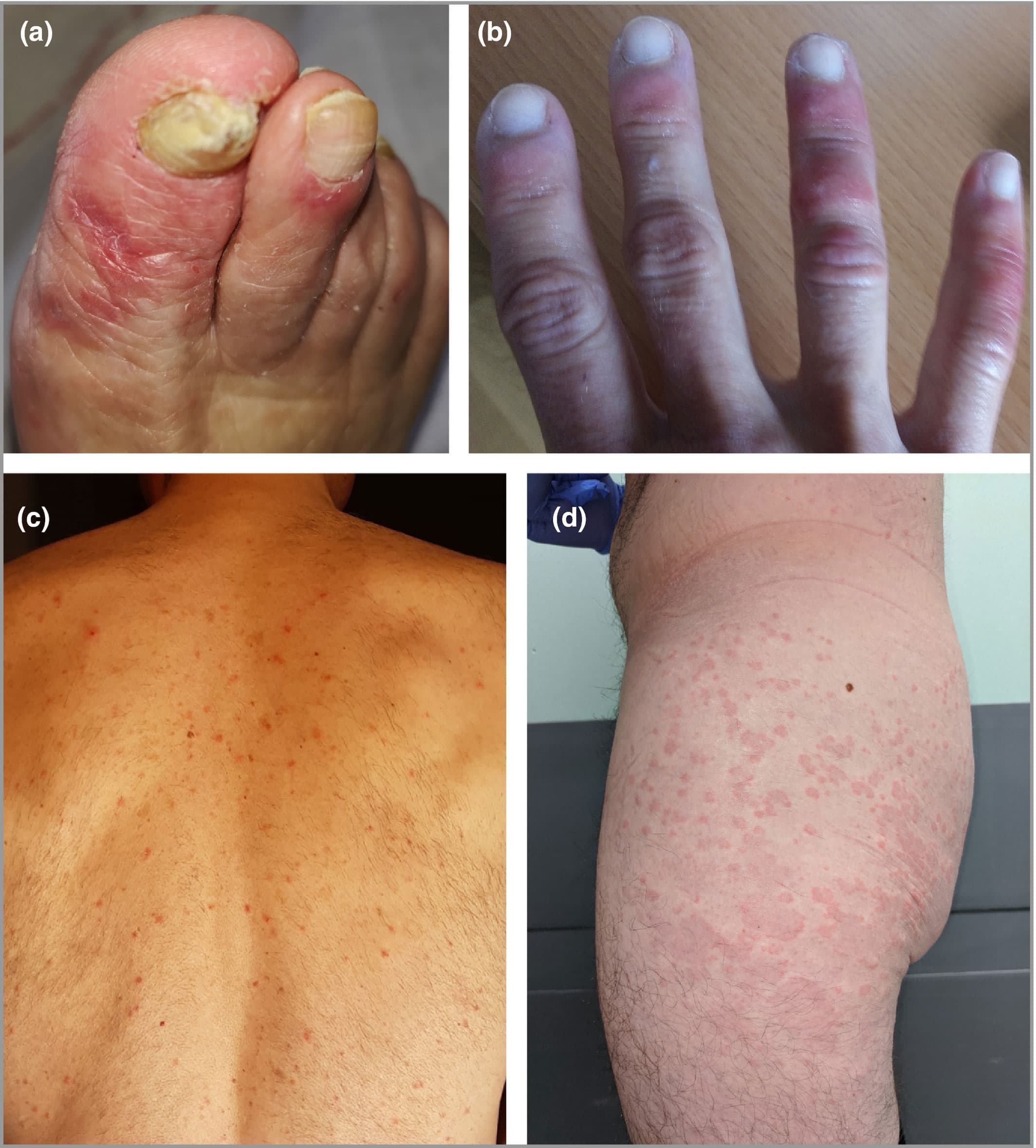 British Journal of Dermatology